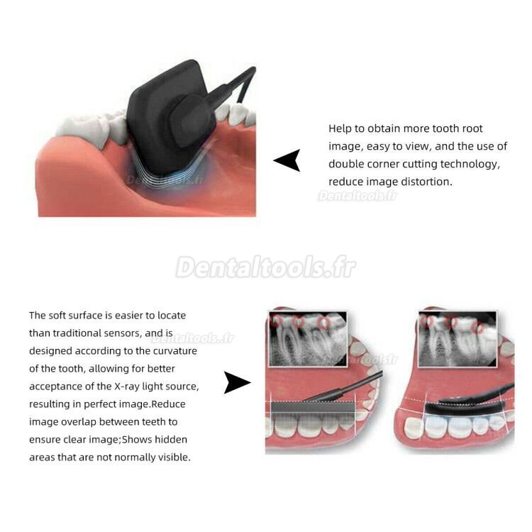 Capteur Radio Dentaire RVG Capteur Intraoral Radiologique Dentaire Numérique