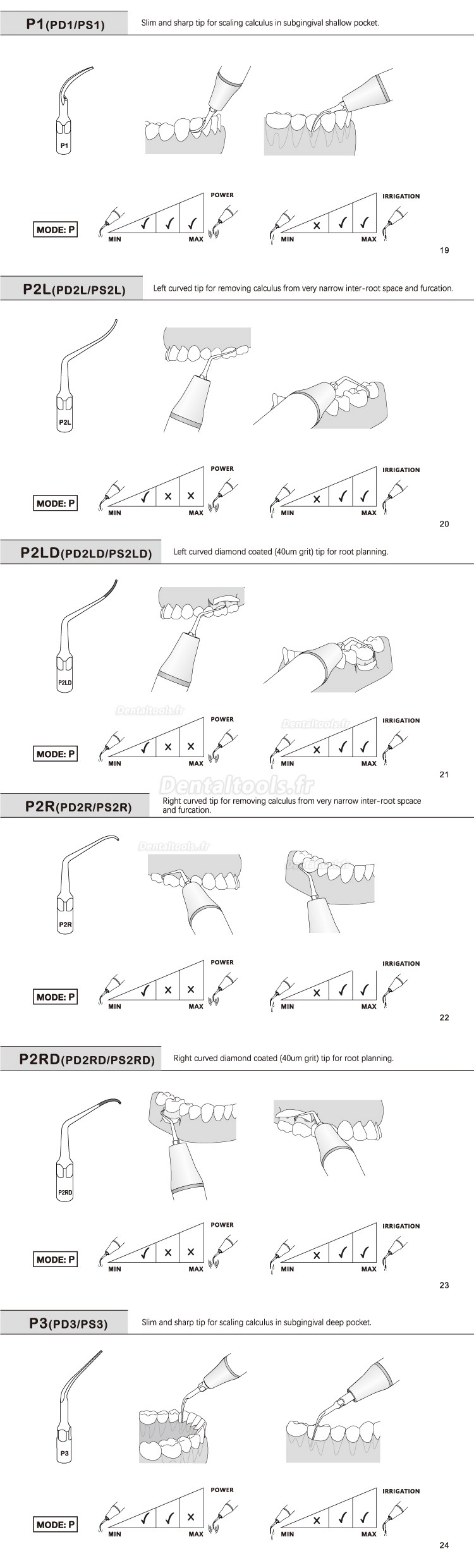 5Pcs Inserts ultrasonique parodontal P2L P2R P2LD P2RD P5 P6 P7 P8 P10 P11 P12 P14L compatible avec piece a main Ultrason Refine EMS Woodpecker