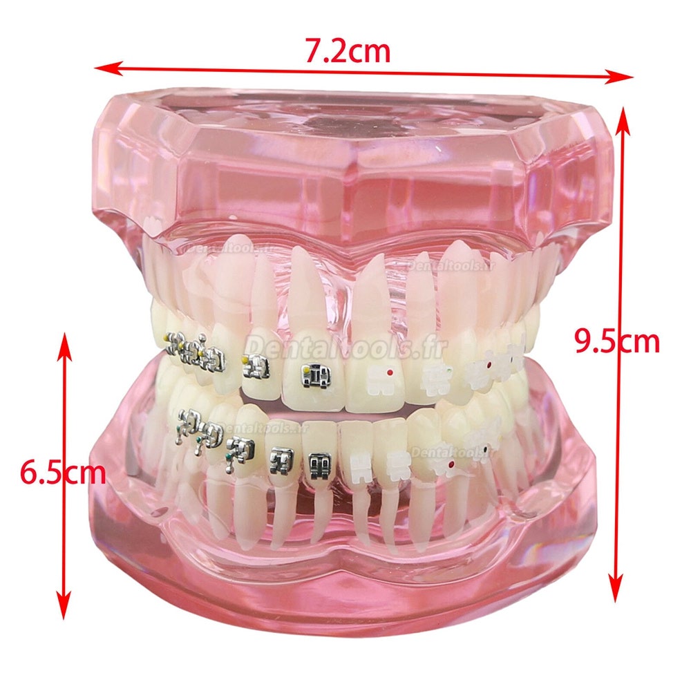 Modèle de dents orthodontiques dentaires + Chaîne auto-ligaturante pour tube de support en céramique et métal