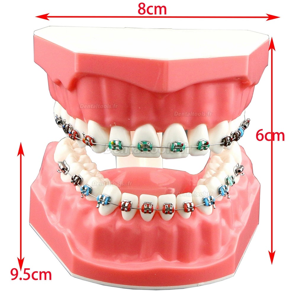 Modèle de dents orthodontiques dentaires + Chaîne auto-ligaturante pour tube de support en céramique et métal