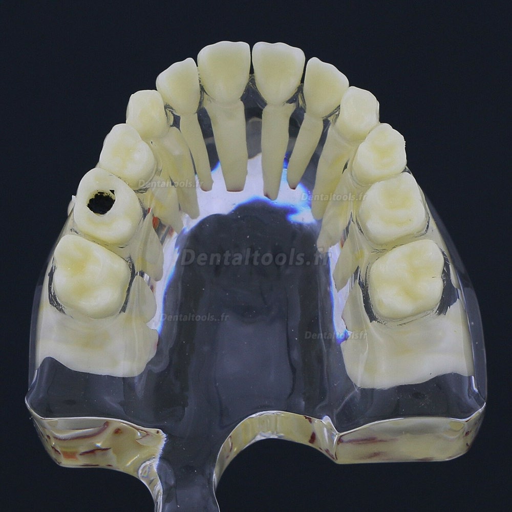 Modèle de dents d'enfants Modèle d'étude de démonstration en pathologie pédiatrique 4002