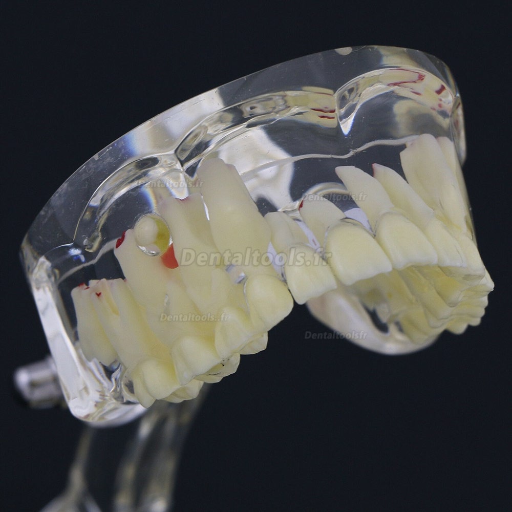 Modèle de dents d'enfants Modèle d'étude de démonstration en pathologie pédiatrique 4002