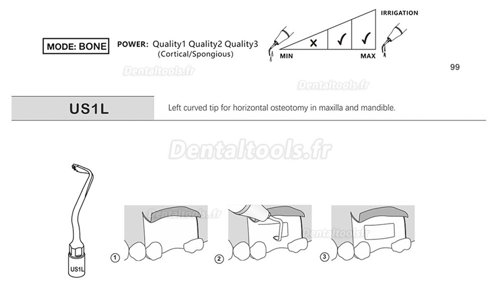 1Pcs Inserts piezochirurgie dentaire US1 US1L US1R US2 US3 US4 US5 US6 US7 US11 US12 compatible avec Mectron Woodpecker