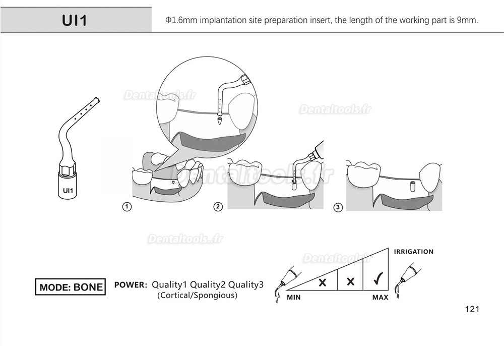 1Pcs inserts de piézochirurgie dentaire pour l'implant de levage des sinus de coupe osseuse Ul1 UI2 UI3 UI4 UI5 compatible avec Mectron Woodpecker