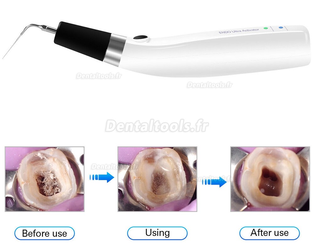 Dental Ultrasonic Cordless Endo Ultra Activator Irrigator Handpiece+Titanium tip