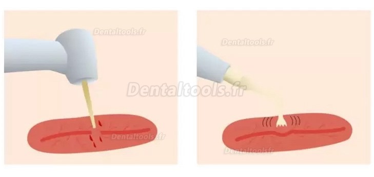 Refine MaxSurgery Unité de piézochirurgie dentaire système de chirurgie osseuse piézo-électrique par ultrasons