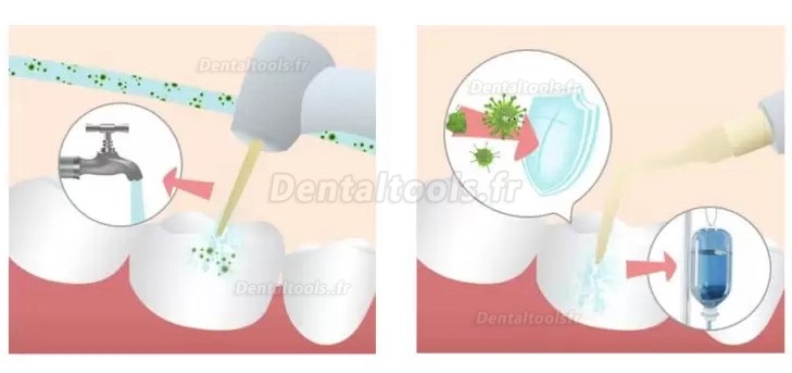 Refine MaxSurgery Unité de piézochirurgie dentaire système de chirurgie osseuse piézo-électrique par ultrasons