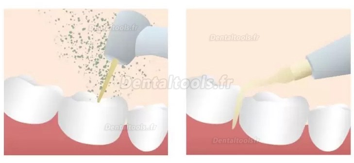 Refine MaxSurgery Unité de piézochirurgie dentaire système de chirurgie osseuse piézo-électrique par ultrasons