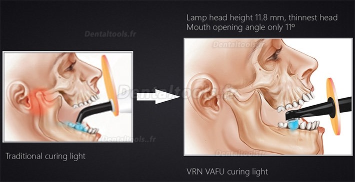 VRN Vafu 5W Lampe de polymérisation Led dentaire sans fil 2500MW avec 4 LED Lumière bleue