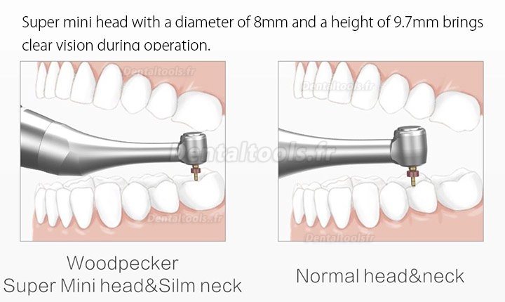 Woodpecker Ai-Motor Dental Endo Motor Apex Locator Brushless Cordless