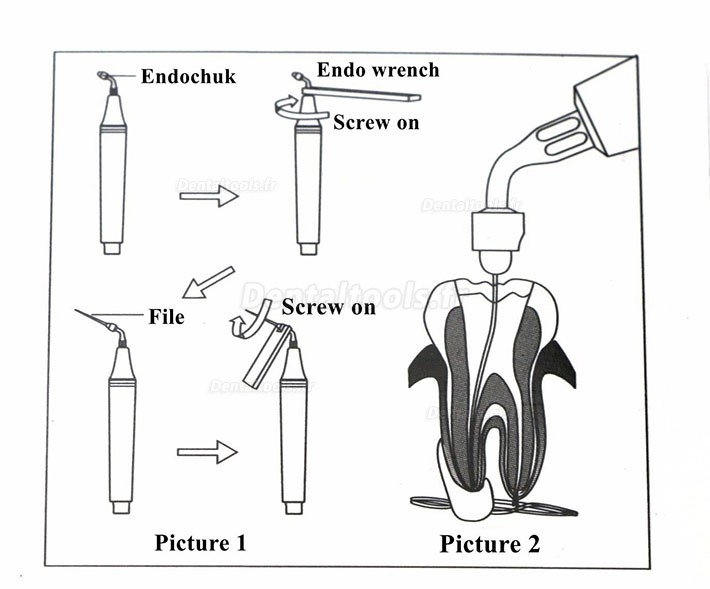 2018 Nouveau TW-E1 Pointe E1 E2 Clé de NITI K Kit Dentaire de Canal Radiculaire Endodontique de Woodpecker