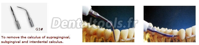 Woodpecker® insert detartrage dentaire Piézo Insert G3 compatible EMS & UDS (10 Pcs)