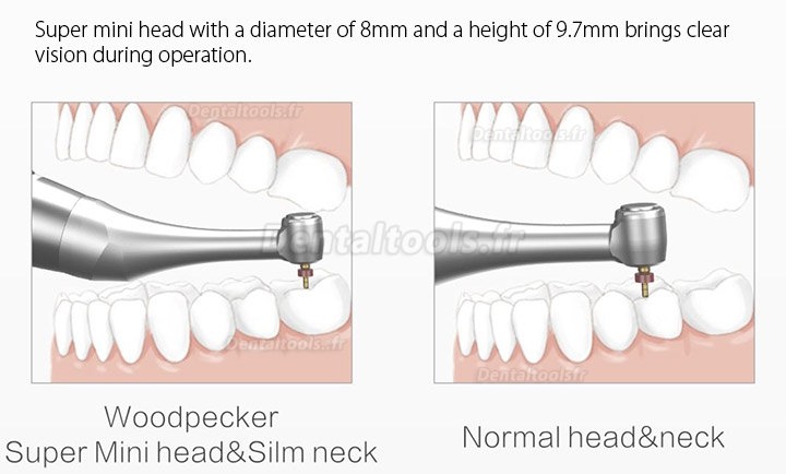 Woodpecker Motopex brushless moteur d'endodontie avec localisateur d'apex intégré