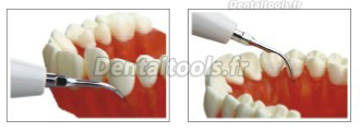 WOODPECKER® P1 inserts de parodontie EMS compatible éliminer les dépôts gingivaux 5PCS