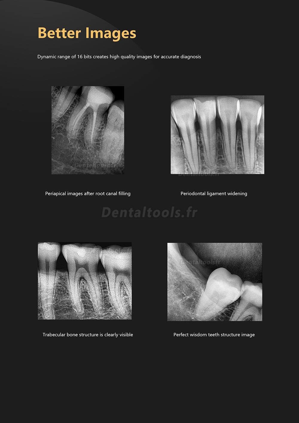 Capteur Radio Dentaire RVG Capteur Intraoral Radiologique Dentaire Numérique