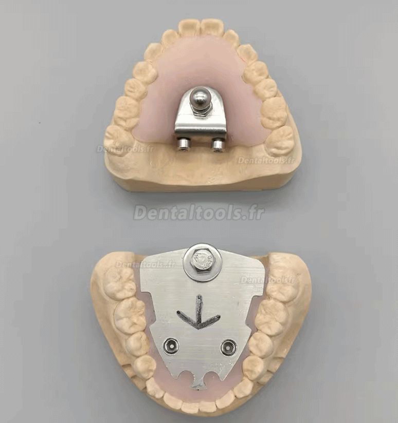 Enregistreur vertical de relation centr&eacute;e avec traceur gothique pour patients &eacute;dent&eacute;s