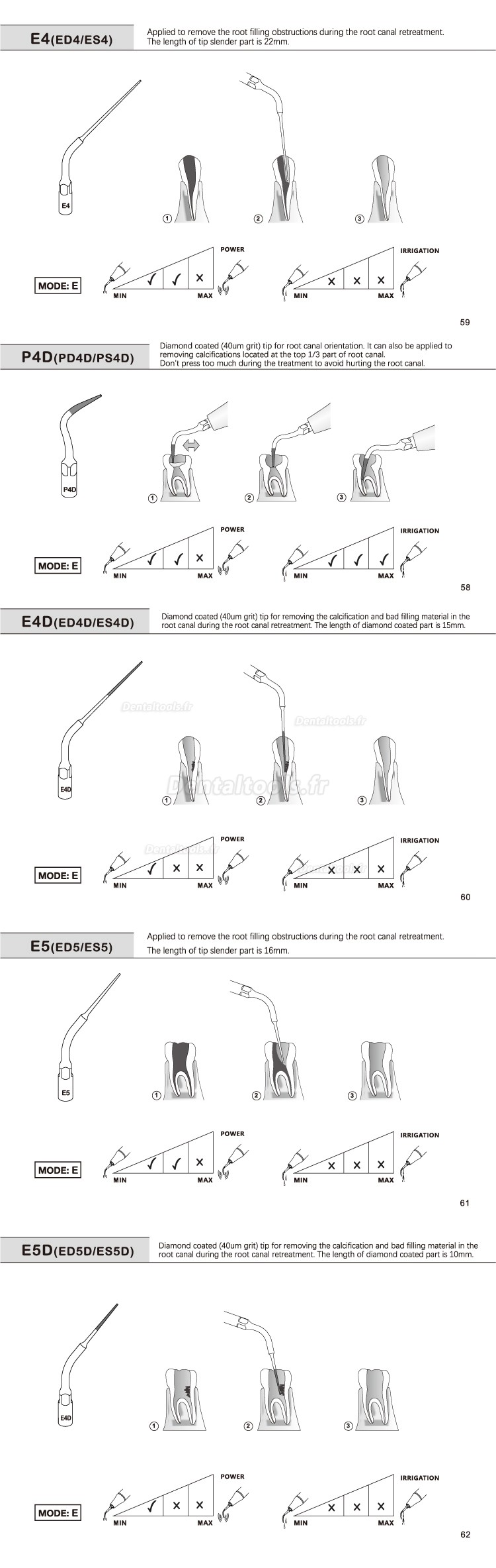 5Pcs Inserts ultrasonique endodontie E1 E2 E3 E4 E4 E6 E7 E8 E9 E10 E11 E14 E15 compatible avec REFINE EMS MECTRON WOODPECKER