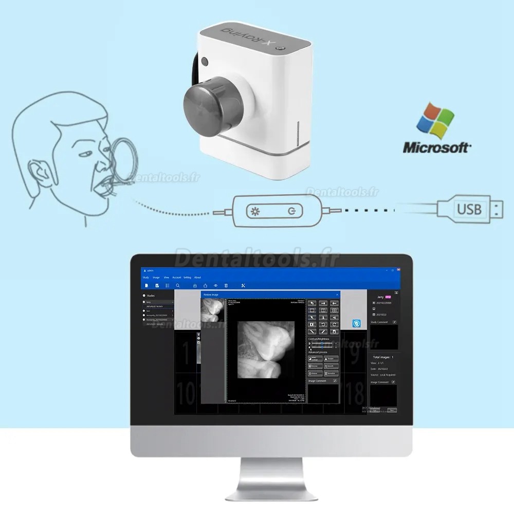 Vente de Capteur Radio Dentaire RVG Capteur Intraoral Radiologique ...